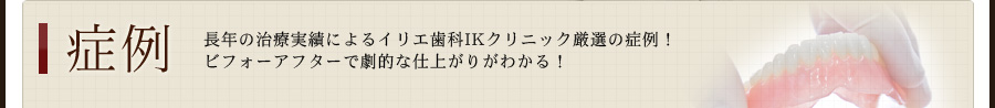 症例